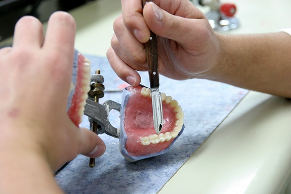 Full Mouth Reconstruction: Replacing Teeth With Dentures